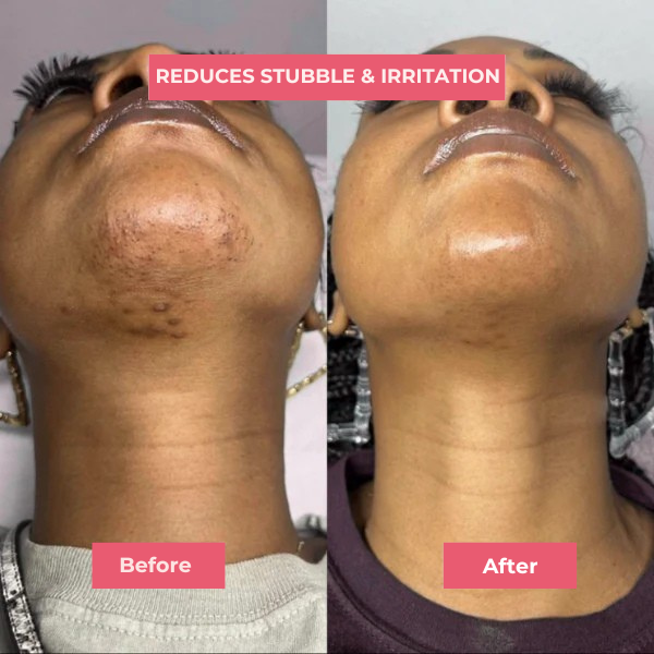 Zarien™ Silken Skin Serum